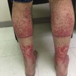 These are the consequences of sleeping with the… See more