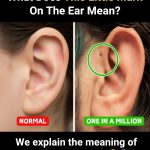 What Does This Little Mark On The Ear Mean?