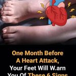 6 Foot Signals That Hint at Heart Trouble Early