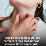 People with six or more oral sex partners in their lifetime have increased throat cancer risk, according to study.
