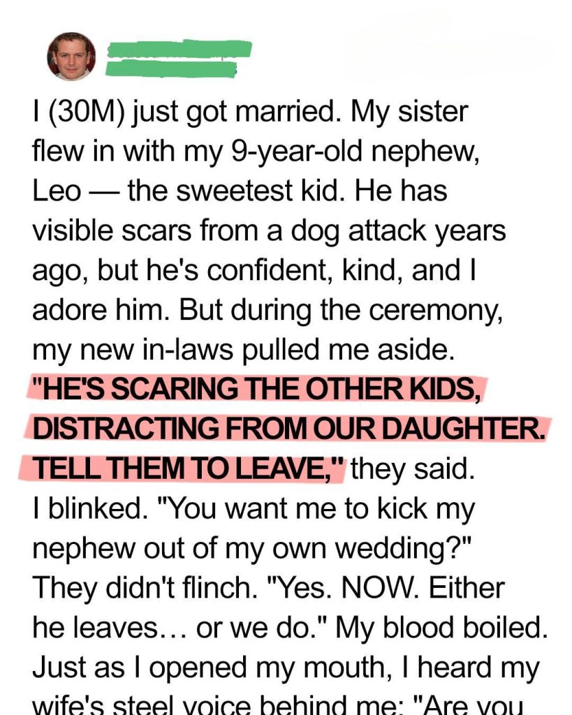 My In-Laws Asked Me to Exclude My Nephew from Our Wedding Because of His Scars — My Wife Taught Them a Valuable Lesson