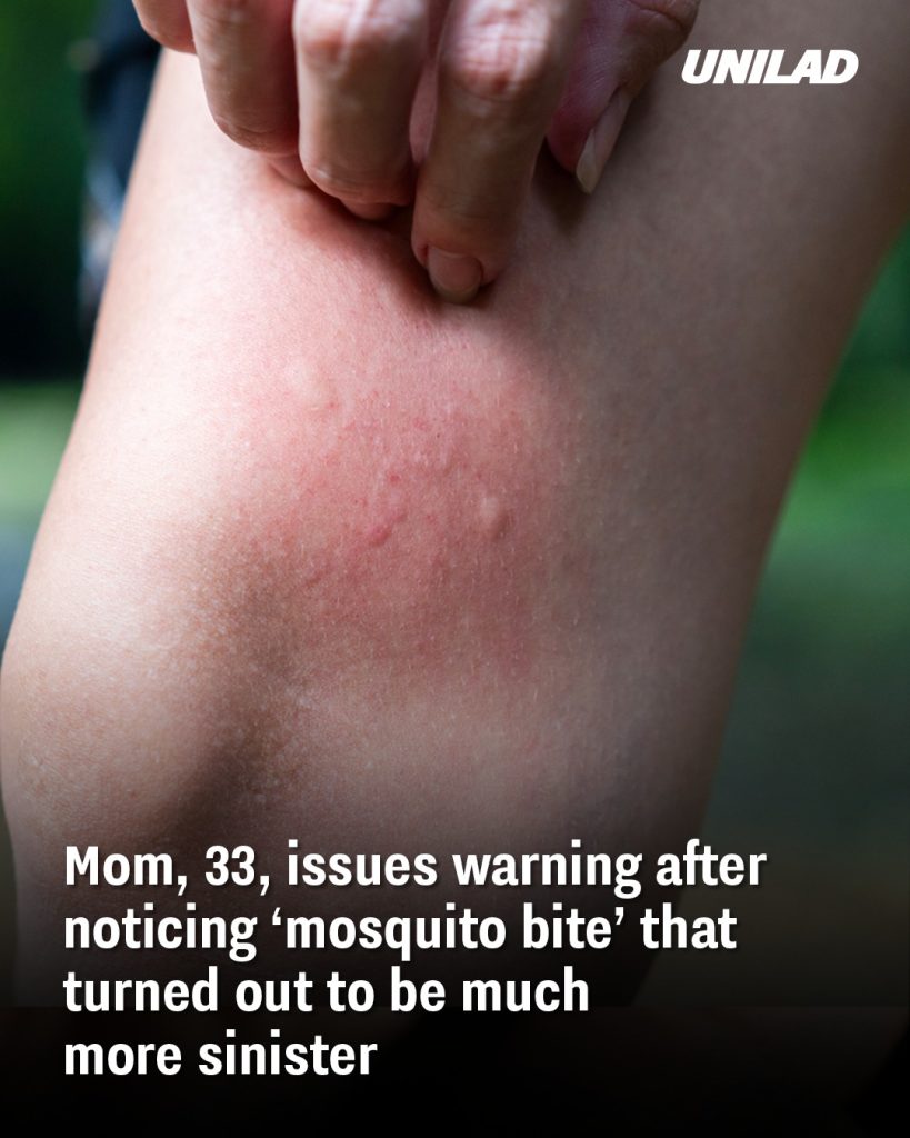Mom, 33, issues warning after noticing ‘mosquito bite’ that turned out to be much more sinister