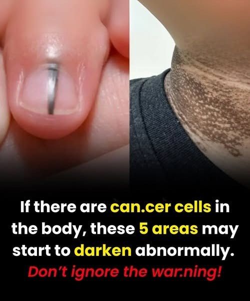 Itching in These 8 Body Areas Could Be a Warning Sign of Cancer — Here’s What Seniors Need to Know