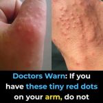 Don’t overlook these small red spots on your arm – They could be important w.arning signs