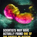 Study identifies possible connection to autism development