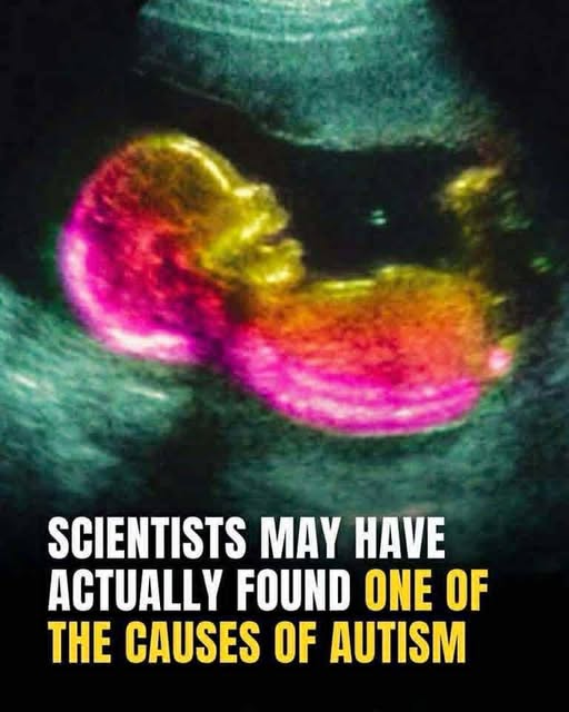 Study identifies possible connection to autism development