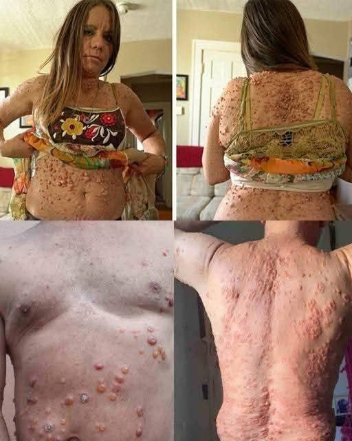 These are the consequences of sleeping with…See more in comment