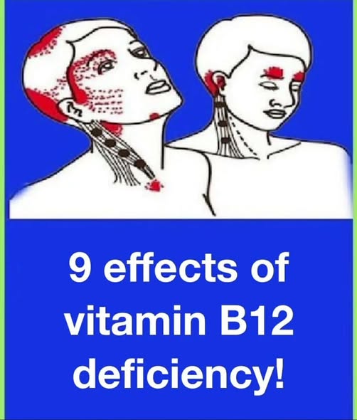 9 symptoms of vitamin B12 deficiency!