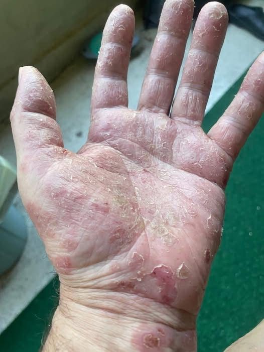 These are the consequences of sleeping with…See more